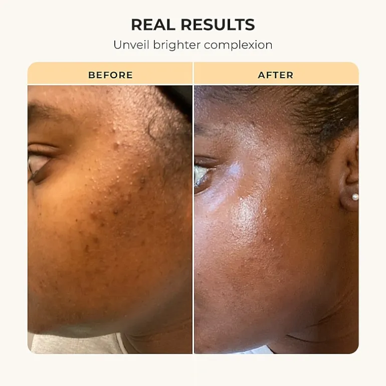 Buttah Skin Cocoshea Transforming Skin Kit