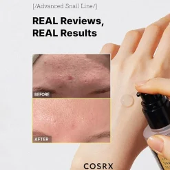 Cosrx Advanced Snail 96 Mucin Power Essence Face Treatment