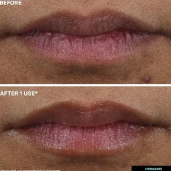 Kate Somerville Hydrakate® Pro-Collagen Lip Oil Elixir
