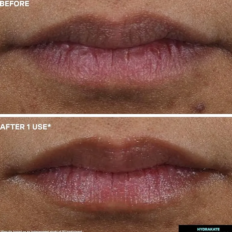 Kate Somerville Hydrakate® Pro-Collagen Lip Oil Elixir