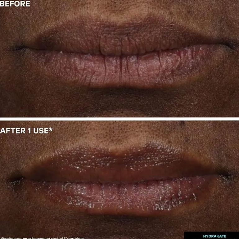 Kate Somerville Hydrakate® Pro-Collagen Lip Oil Elixir