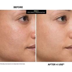 Kate Somerville Mega-C® 30% Vitamin C Brightening Facial