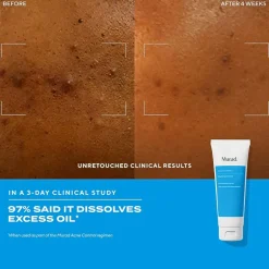 Murad Acne Control Clarifying Cleanser