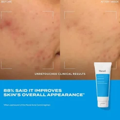Murad Acne Control Clarifying Cleanser