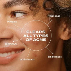 Murad Biome-Balancing Clear & Prevent Acne Treatment Serum