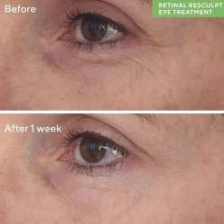 Murad Retinal Resculpt Eye Lift Treatment