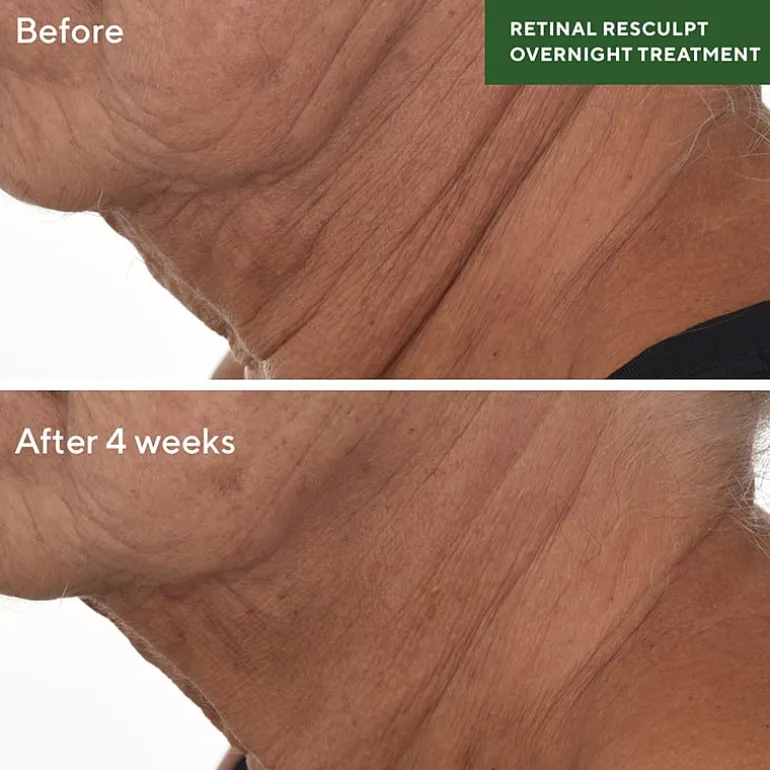 Murad Retinal Resculpting Overnight Treatment Facial Treatment