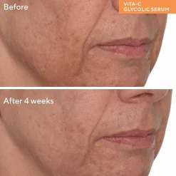 Murad Vita-C Glycolic Brightening Serum Face Serum