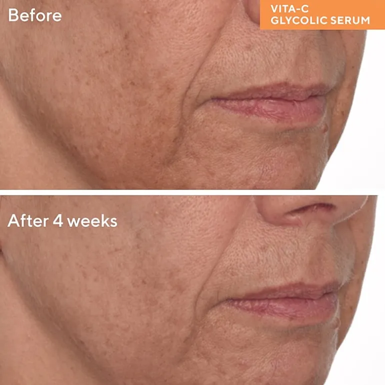 Murad Vita-C Glycolic Brightening Serum Face Serum