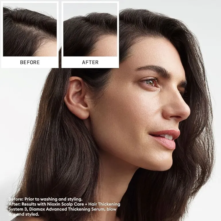 Nioxin® System 3 Scalp Therapy Conditioner - 33.8 oz.