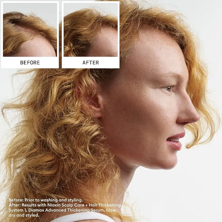 Nioxin® System 1 Scalp + Hair Shampoo 33.8 oz.