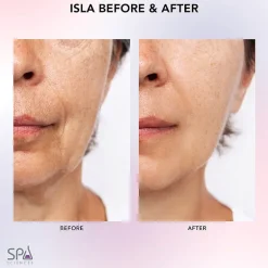 Spa Sciences Isla Sonic Face & Body Roller Contouring System